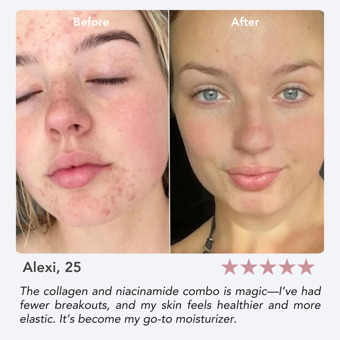 Anti-Aging Collagen Jelly Cream