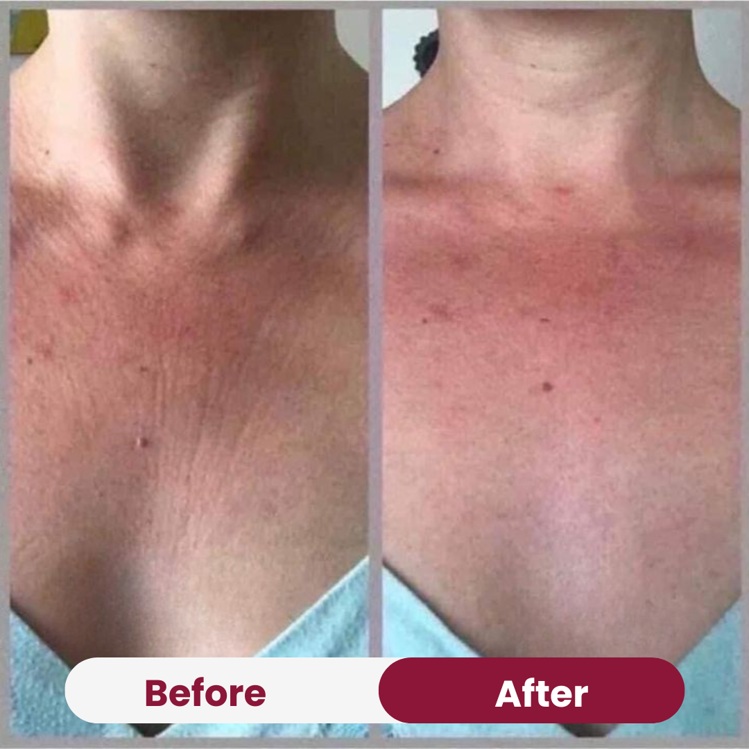 Chest Anti-Wrinkle Patch