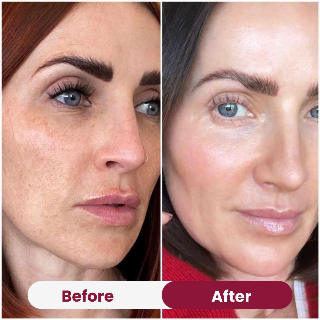 The Overnight Glow Set