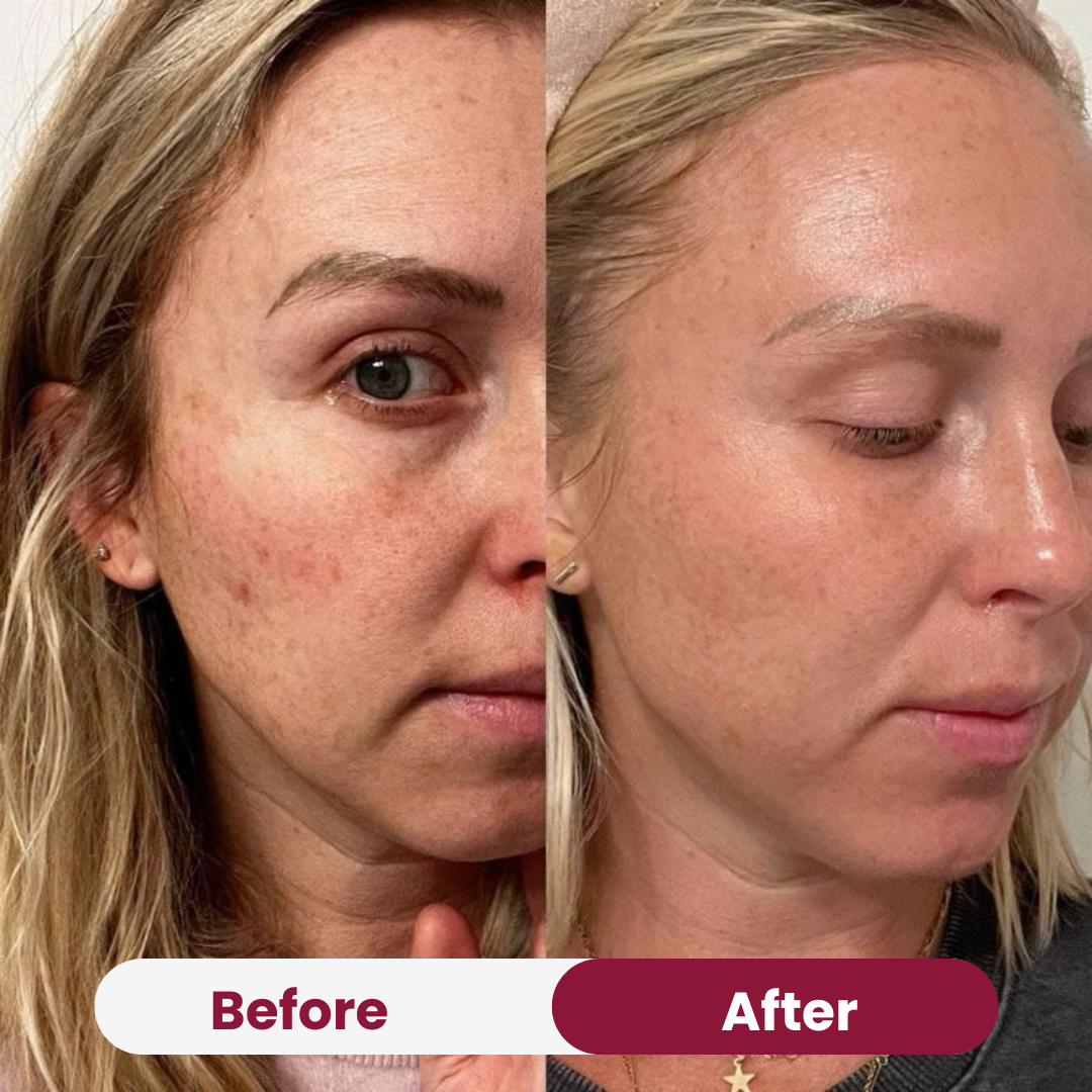 Collagen Peptide Moisturizer