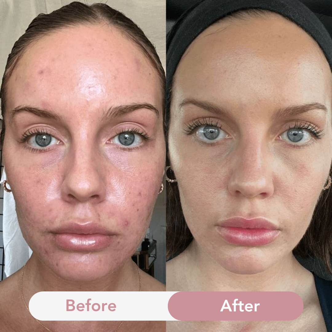 Anti-aging collageen jelly crème