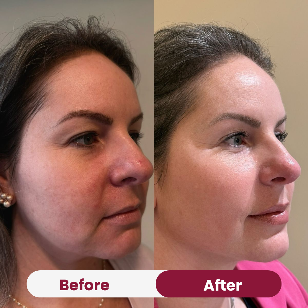 Collagen Glow Sunscreen SPF 50