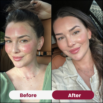 Soothing & Anti-Aging Pack