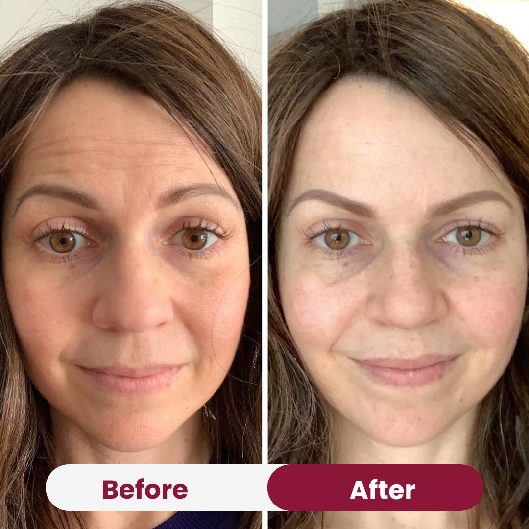 Soothing & Anti-Aging Pack