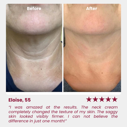 Neck Tightening Cream