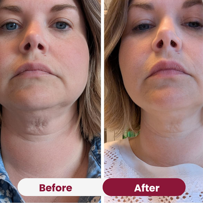 Neck Tightening Cream