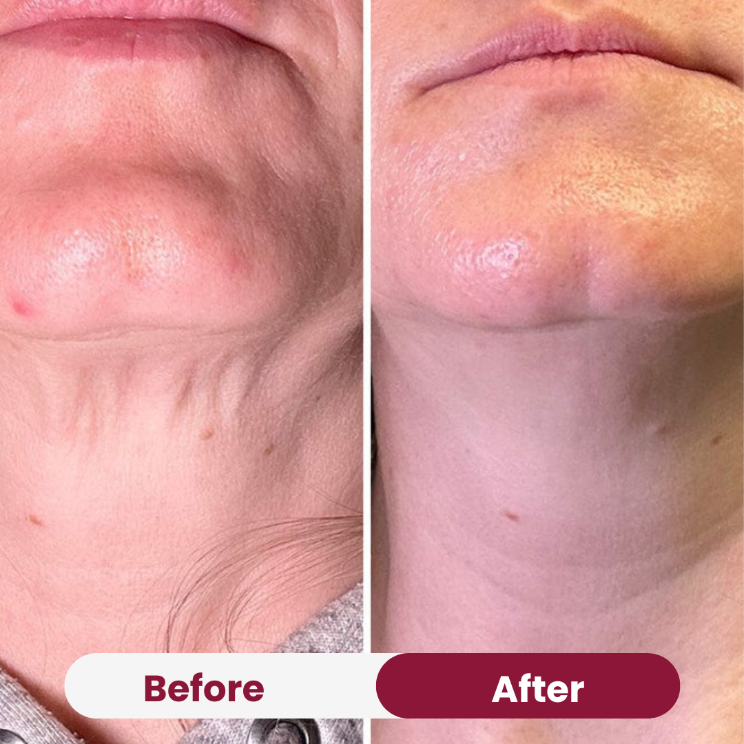 Neck Tightening Cream