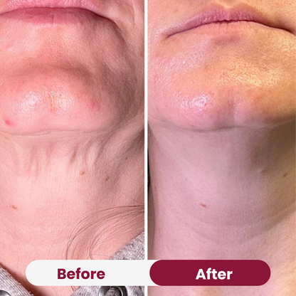 Neck Tightening Cream
