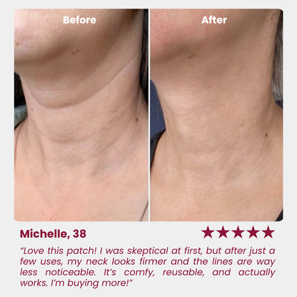 Neck Anti-Wrinkle Patch