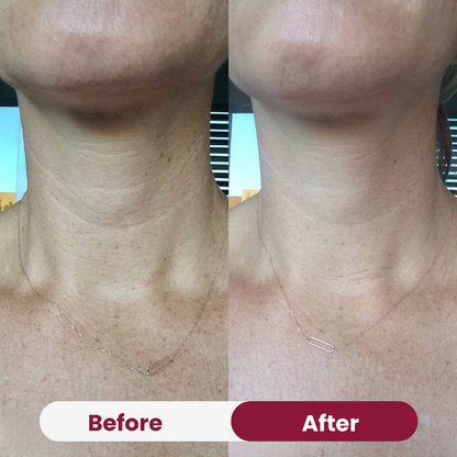 Neck Anti-Wrinkle Patch