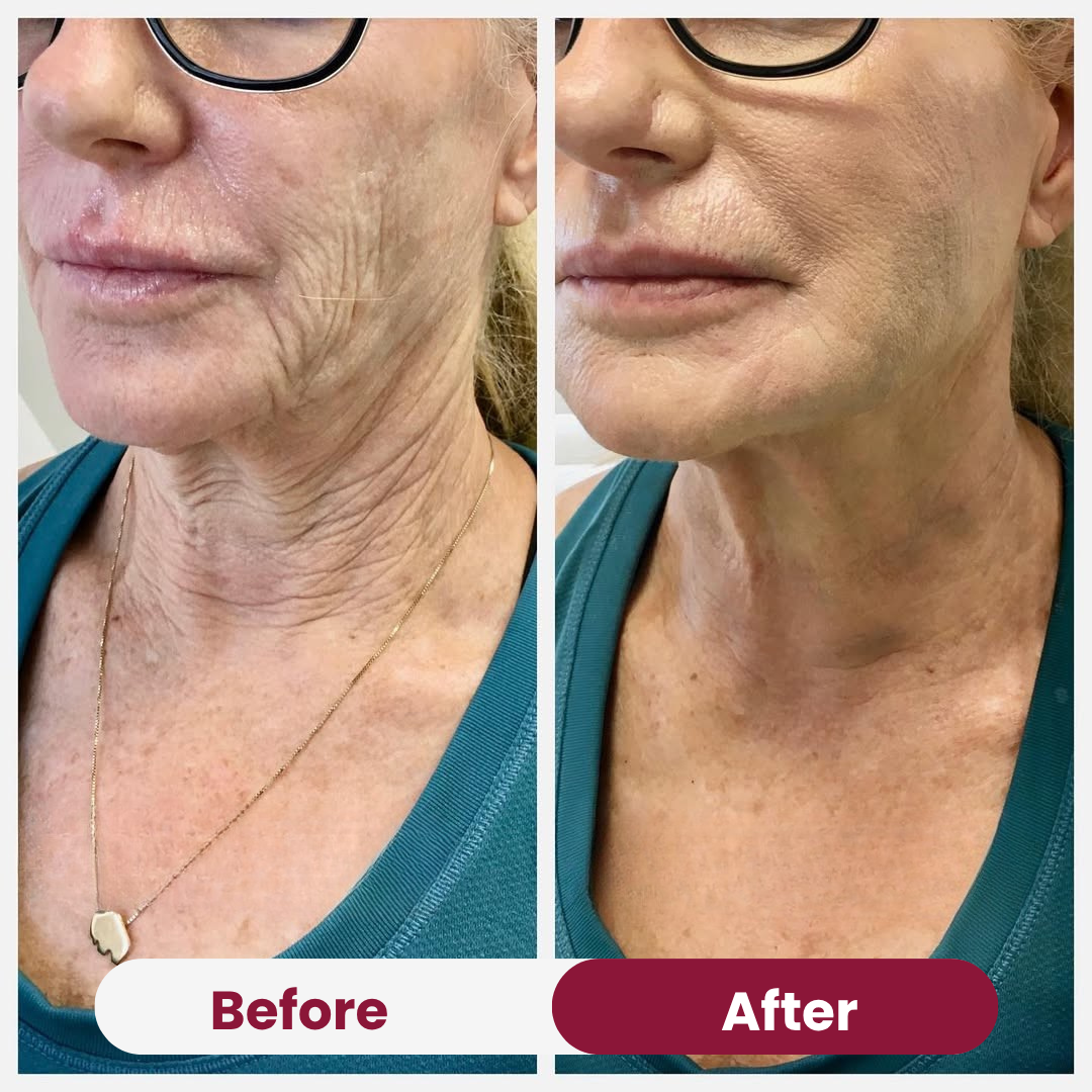 Christmas Anti Aging Bundle