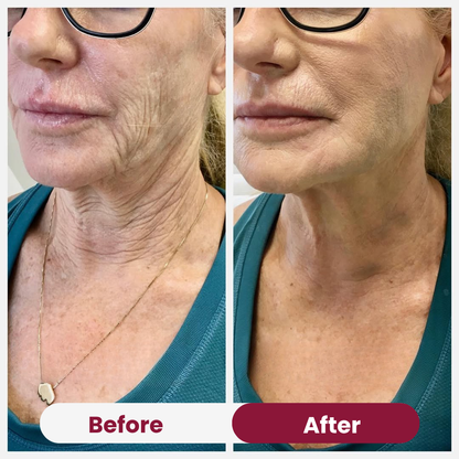 Christmas Anti Aging Bundle