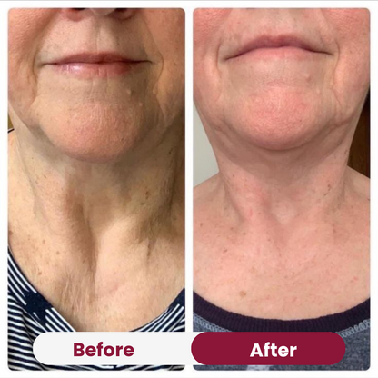 Christmas Anti Aging Bundle