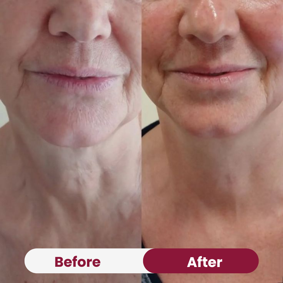 Face + Neck Firming Essentials