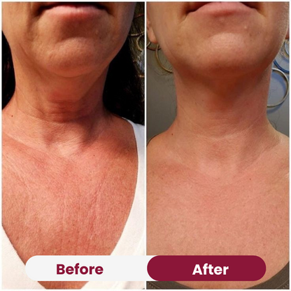 Chest Anti-Wrinkle Patch