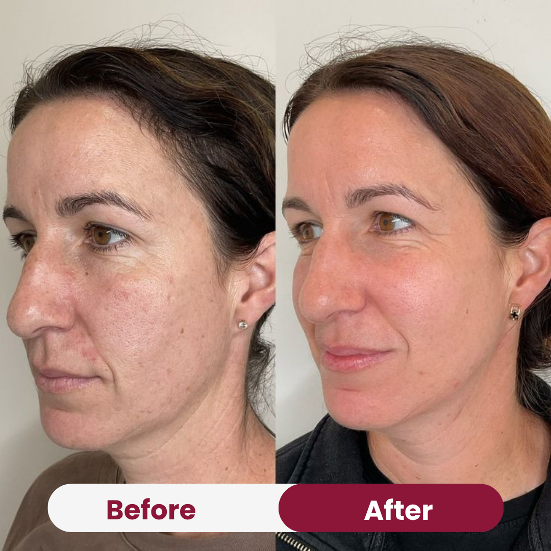 Anti-aging Niacimide 10+ Serum