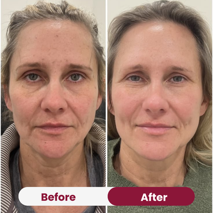 Collagen Peptide Moisturizer
