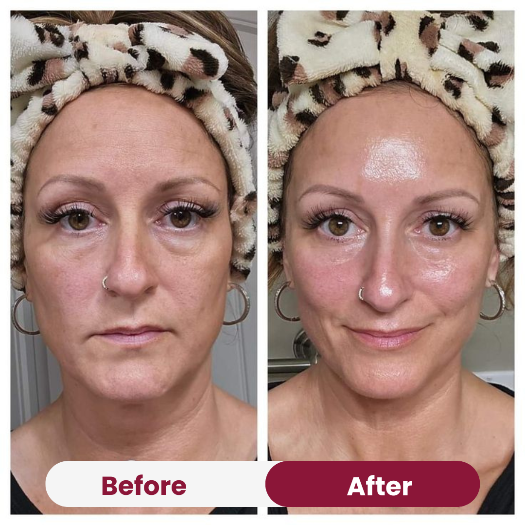 Collagen Peptide Moisturizer