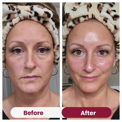 Collagen Peptide Moisturizer