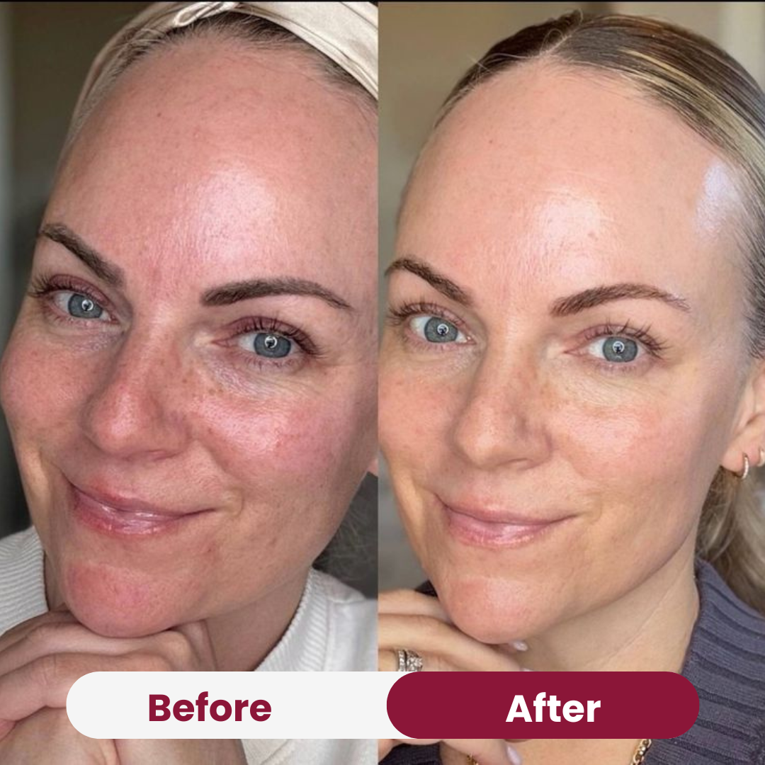 Anti-aging Niacimide 10+ Serum