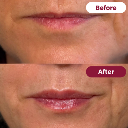 Collagen Mouth Tape