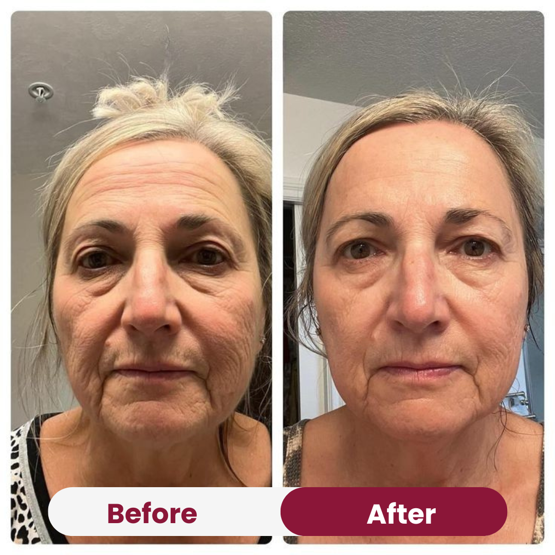 Zalm PDRN Collageen Masker