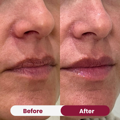 Collagen Mouth Tape