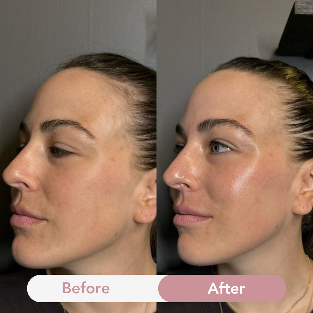 Anti-aging collageen jelly crème