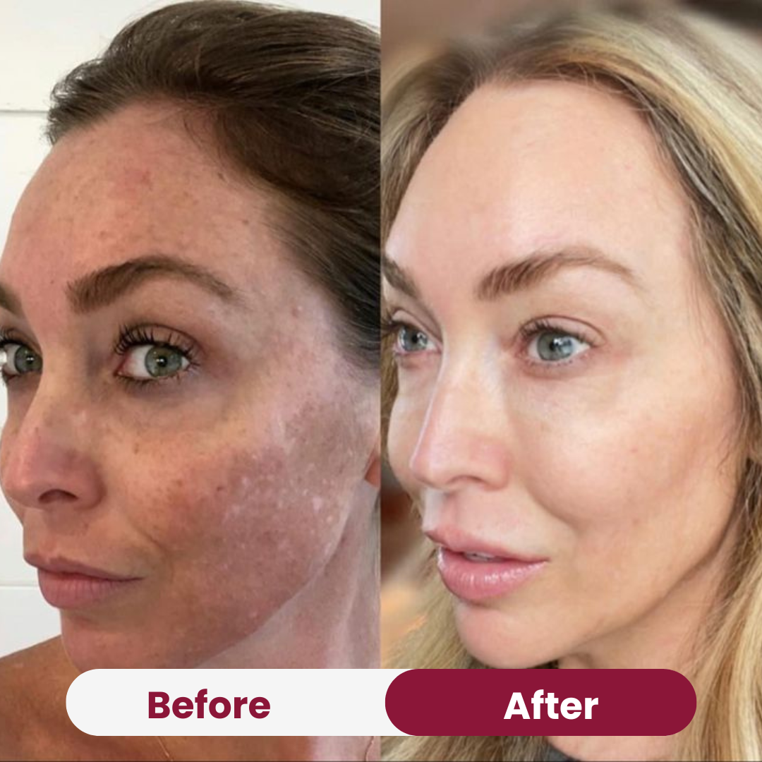 Anti-Aging Power Duo