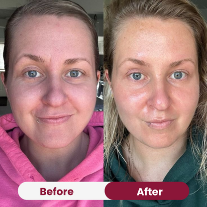 Zalm PDRN Collageen Masker